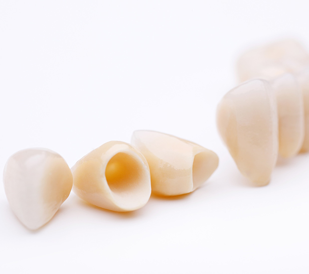 Crystal Lake Dental Crowns and Dental Bridges