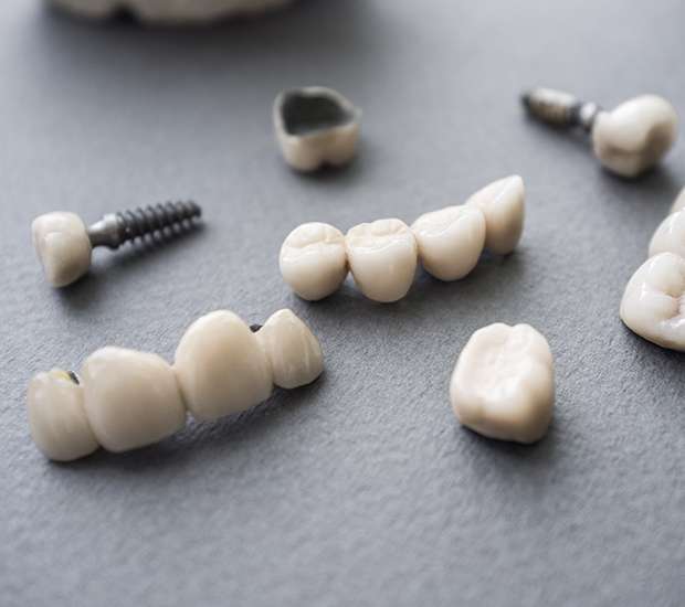 Crystal Lake The Difference Between Dental Implants and Mini Dental Implants